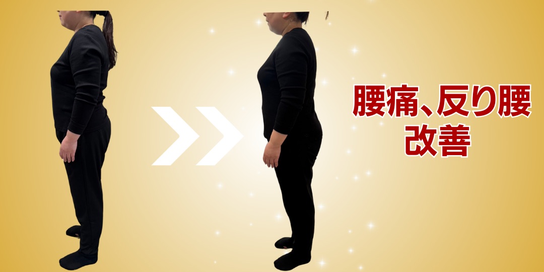 40代女性 姿勢改善 Before After 腰痛・反り腰改善